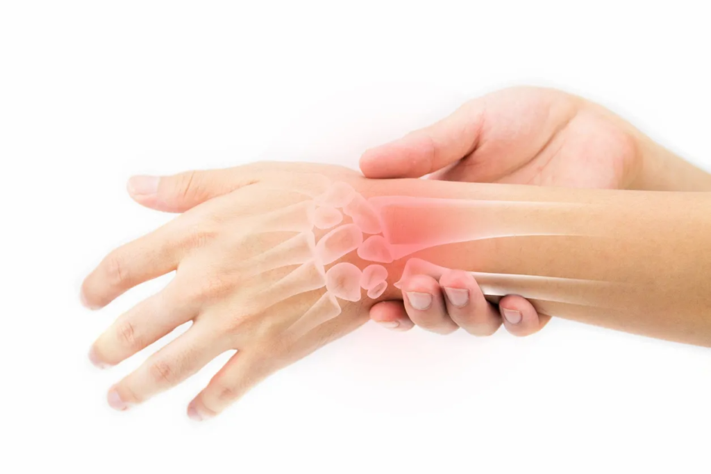 Arthritis and Joint Pain in the Hand and Wrist