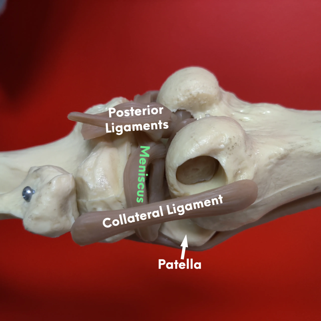 knee pain: knee ligaments