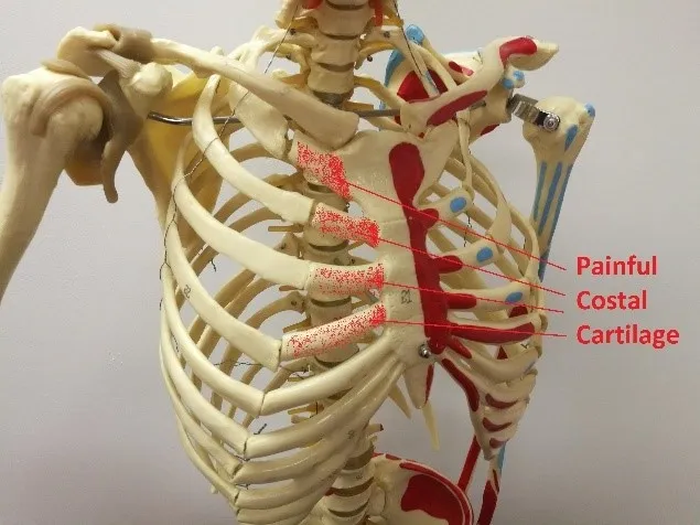 Emotional Rib Rib Pain - Reactivate Chiropractic and Rehab - Diagnosis and Treatment