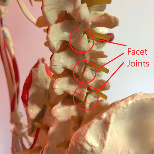 Facet Syndrome